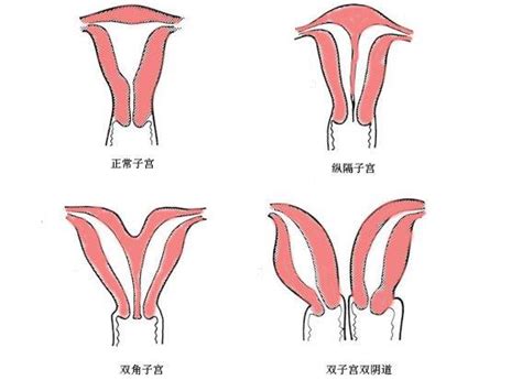 為主人檢索到 子宮^